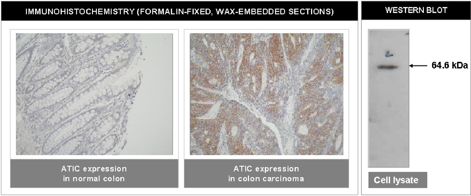 "Left and Center: Immunohistochemical staining of normal colon tissue and colon carcinoma tissue using ATIC antibody (Cat. No. X2062M).
Right: Western blot using ATIC antibody on HT29 cell lysate."